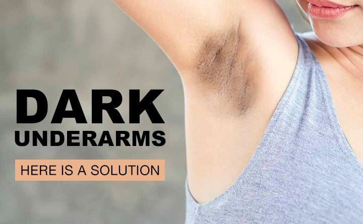 How To Treat Dark Underarms at Home - Nuutjob