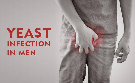 Yeast Infection In Men (A Complete Guide) - Nuutjob